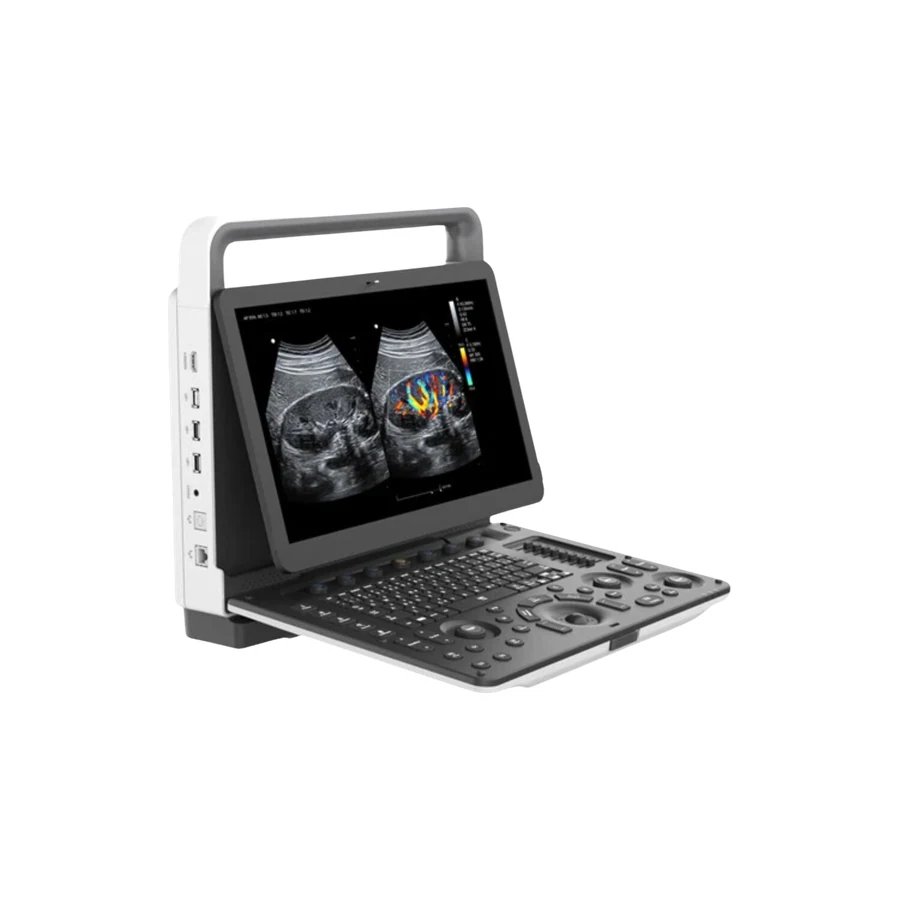 Zoncare Portable Colour Doppler Ultrasound